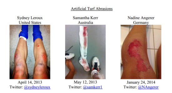 The cost of playing on artificial turf has taken a toll on pro womens players. - Photo courtesy of Americantouchline.com